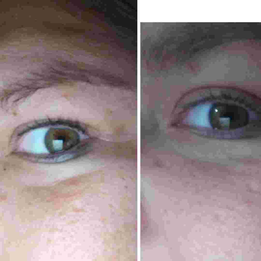 4-IN-1 EYE CREAM: Your Solution for Puffy Eye Bags, Wrinkles & Dark Circles